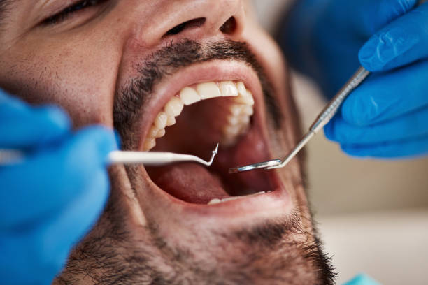 Best Emergency Tooth Extraction in Piedmont, OK